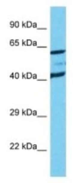 Reduced Folate Carrier/SLC19A1 Rabbit anti-Human, Polyclonal, Novus Biologicals:Antibodies:Primary